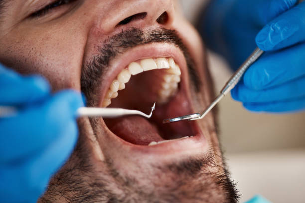 Best Urgent Dental Care for Toothache in Chena Ridge, AK